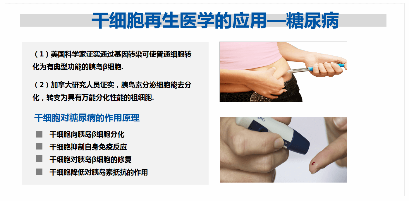 干細胞療法治療糖尿病