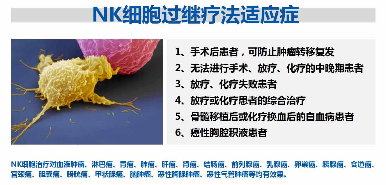 NK細(xì)胞過繼療法適應(yīng)癥