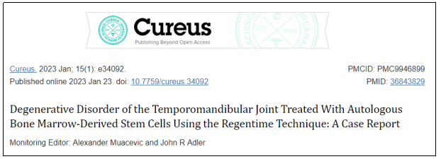Cureus期刊最新報(bào)道：干細(xì)胞治療1例下頜關(guān)節(jié)退行性疾病，隨訪顯示完全康復(fù)